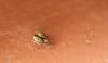 Gibbaranae inconnu